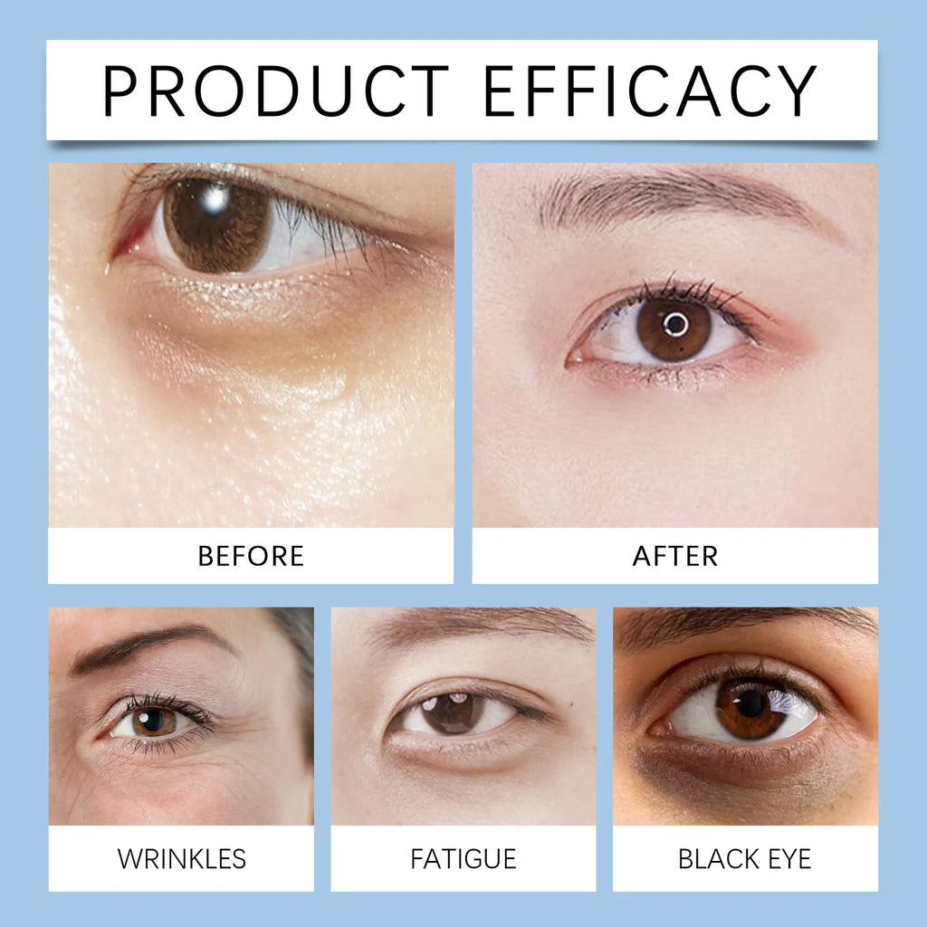 Moisturizing Eye Cream: Gentle, Soft and Hydrating Care for the Eye Area. Apply and massage.
