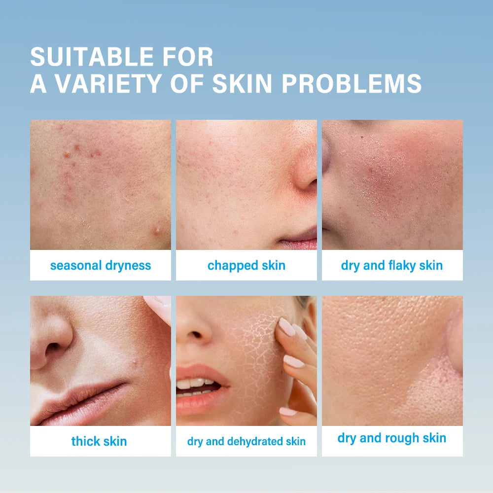 Super Hydrating Cream Moisturizing Facial Skin Dry Long-lasting Moisturizing Restoring Skin Barrier Suitable For All Skin Creams