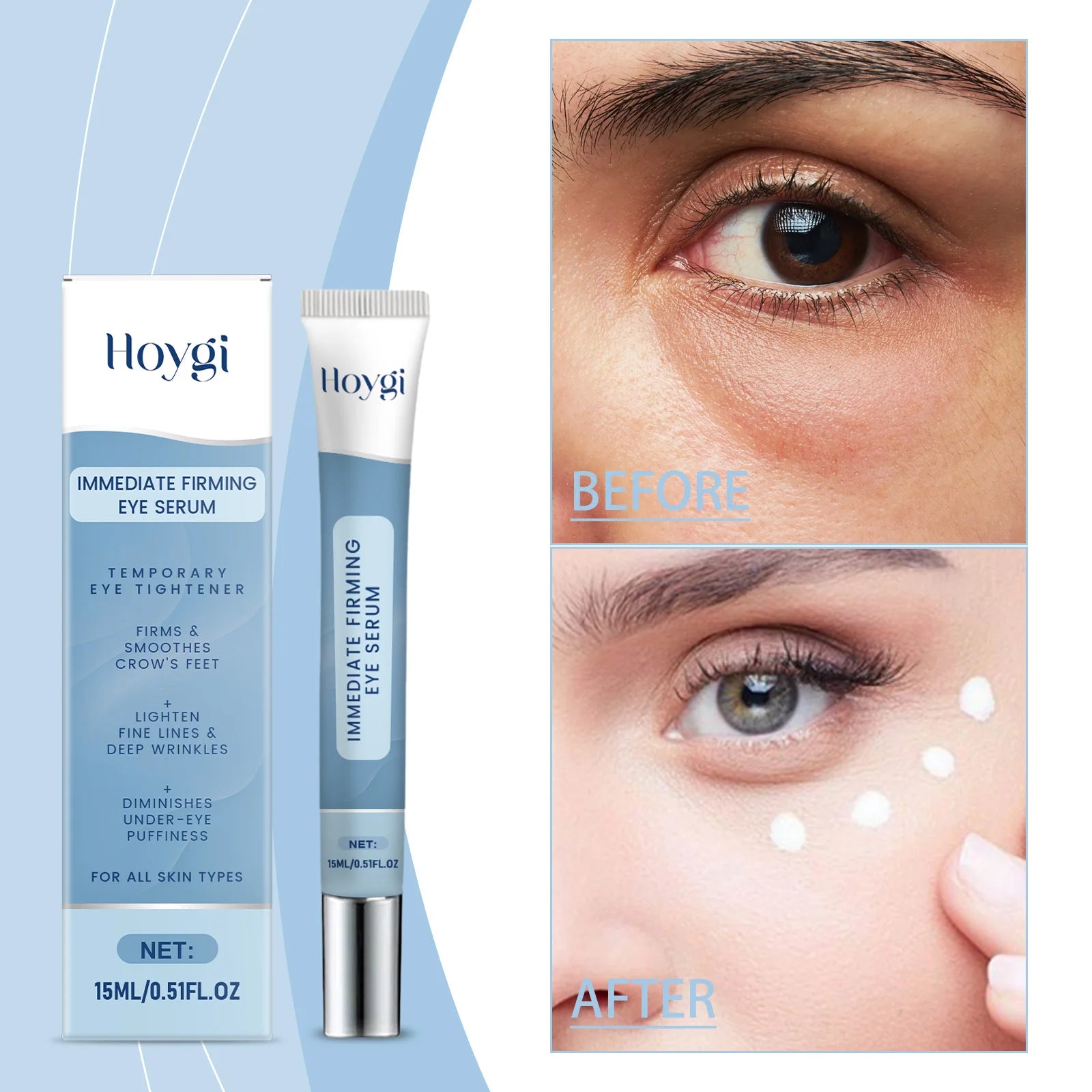 Moisturizing Eye Cream: Gentle, Soft and Hydrating Care for the Eye Area. Apply and massage.